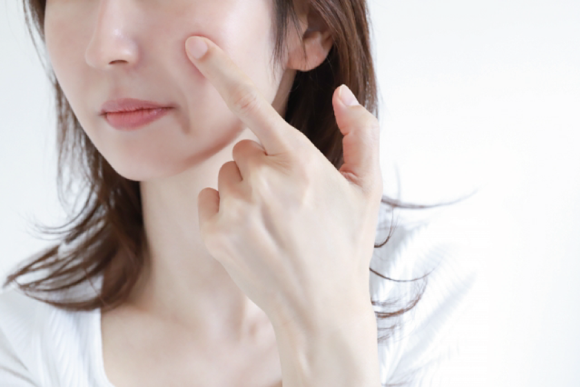 ニキビ肌に悩みを持つ女性
