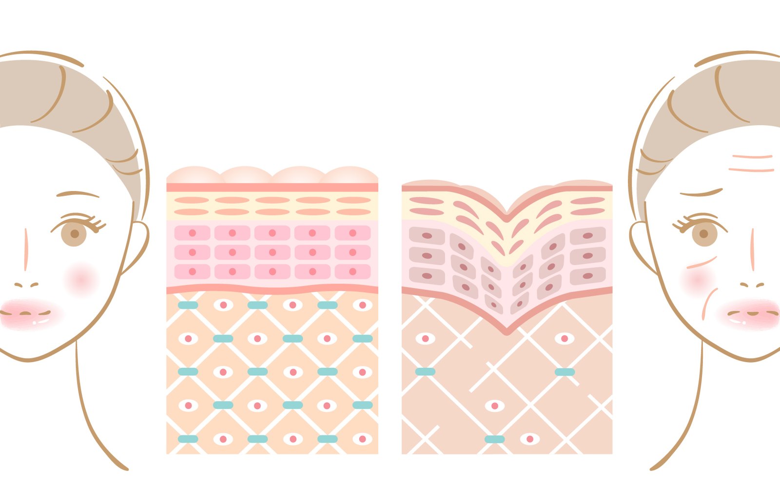 肌のハリ感を比べたイラスト